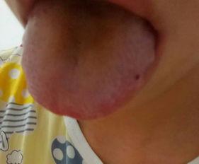 嗓子发炎吃籽瓜,天然食疗的神奇疗效